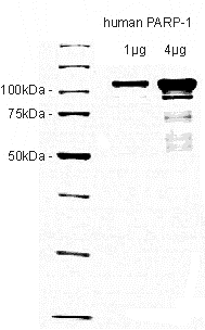 PARP-1 (human), (recombinant) (high purity) image