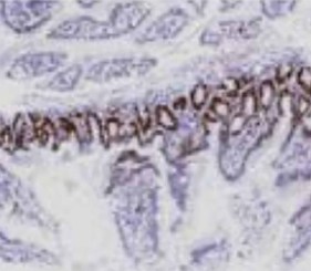 HIGHDEF-IHC-Chromogens