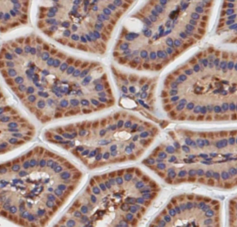 Immunohistochemistry IHC