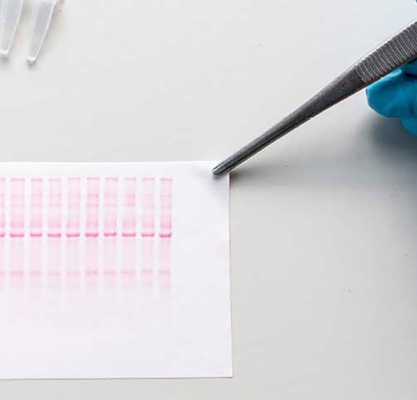 Western blot