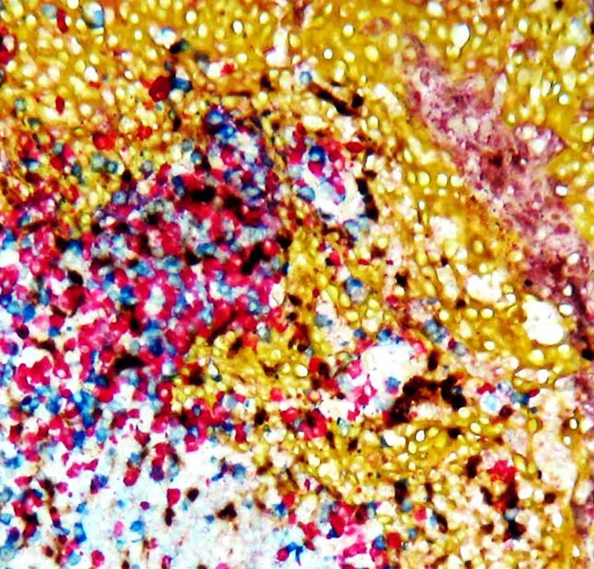 Immunohistochemistry