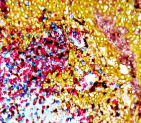 Immunohistochemistry