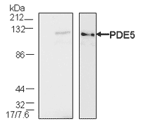 PDE5A polyclonal antibody Western blot