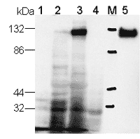 PDE5A polyclonal antibody Western blot