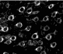 β-COP polyclonal antibody Immunocytochemistry