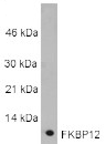 Glucocorticoid receptor β (human) polyclonal antibody Western blot
