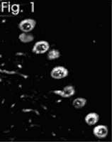 Inositol 1,4,5-trisphosphate receptor (type-I) polyclonal antibody Immunolocalization