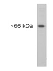 Calreticulin (NT) polyclonal antibody Western blot