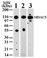 HDAC6 polyclonal antibody Western blot