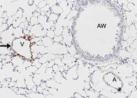 PTX3 polyclonal antibody Immunohistochemistry