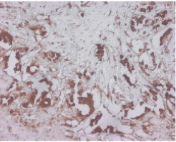 Nitric oxide synthase (endothelial) polyclonal antibody Immunohistochemistry