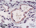 Nitric oxide synthase (endothelial) polyclonal antibody Immunohistochemistry