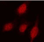 XRCC1 (human) polyclonal antibody Immunoprecipitation