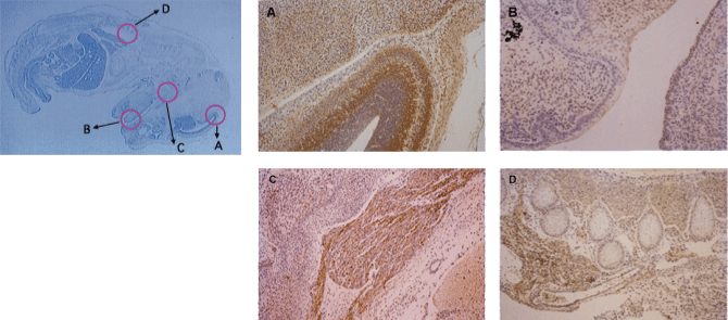 N-cadherin polyclonal antibody Immunohistochemistry