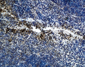 CCR4 (mouse) polyclonal antibody Immunohistochemistry