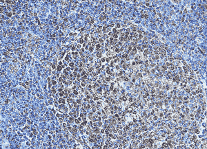 Toll-like receptor 4 polyclonal antibody Immunohistochemistry