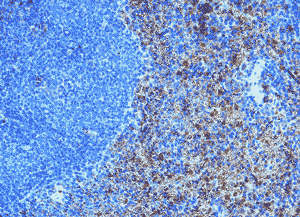 CCR3 (mouse) polyclonal antibody Immunohistochemistry