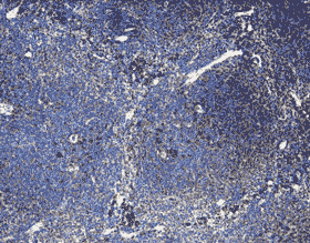 CCR3 (mouse) polyclonal antibody Immunohistochemistry