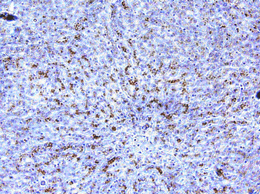 Adiponectin receptor 1 polyclonal antibody Immunohistochemistry
