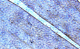 Adiponectin receptor 1 polyclonal antibody Immunohistochemistry