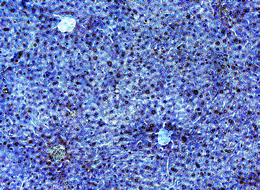 Adiponectin receptor 2 (mouse) polyclonal antibody Immunohistochemistry