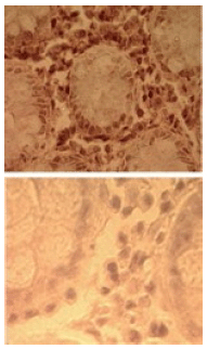 Toll-like receptor 7 polyclonal antibody Western blot