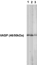 VASP (human) polyclonal antibody Western blot