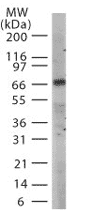 TRIF polyclonal antibody Western blot