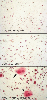 RANKL (soluble) (human), (recombinant) image