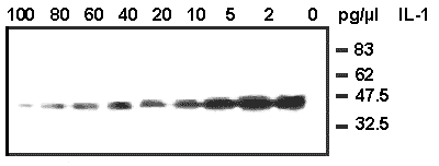 IL-1β (soluble) (human), (recombinant) Western blot