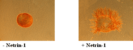 Netrin-1 (human), (recombinant) image