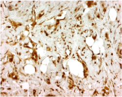 Endothelin-1 monoclonal antibody (TR.ET.48.5) Immunohistochemistry