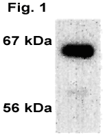 Prolactin receptor monoclonal antibody (U5) Immunohistochemistry