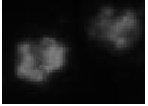 Granzyme B (human) monoclonal antibody (B18.1) image