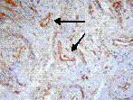 BAFF monoclonal antibody (Buffy-2) Immunohistochemistry