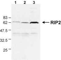 ACRP30headless (human) monoclonal antibody (Ne.Na) Western blot