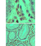 Caspase-3 monoclonal antibody (31A1067) Immunohistochemistry