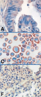 Toll-like receptor 9 monoclonal antibody (26C593.2) Immunohistochemistry