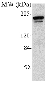 Dnmt1 monoclonal antibody (60B1220.1) Immunohistochemistry