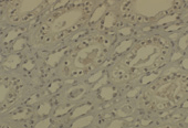 Dnmt1 monoclonal antibody (60B1220.1) Immunohistochemistry