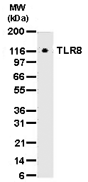 Toll-like receptor 8 monoclonal antibody (44C143) Immunohistochemistry