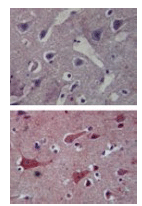 Toll-like receptor 8 monoclonal antibody (44C143) Immunohistochemistry