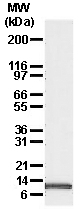 Noxa monoclonal antibody (114C307.1) Western blot