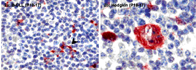 Proteinase inhibitor 9 (human) monoclonal antibody (PI9-17) Immunohistochemistry