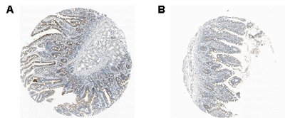 RANKL (human) monoclonal antibody (Ranky-1) Immunohistochemistry
