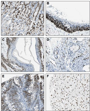IL-33 monoclonal antibody (Nessy-1) Immunohistochemistry