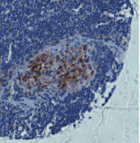 of 106 Jurkat cells using LRRC32