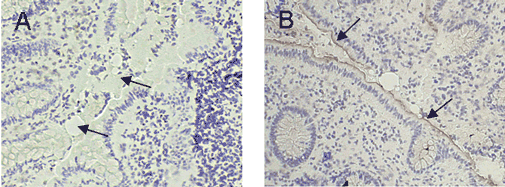 CEACAM1 (human) monoclonal antibody (GM8G5) Immunohistochemistry