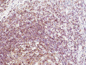 CD45 (human) clonal antibody (E19-G) (Ready-to-Use) Immunohistochemistry