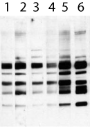 Phosphoserine detection set image